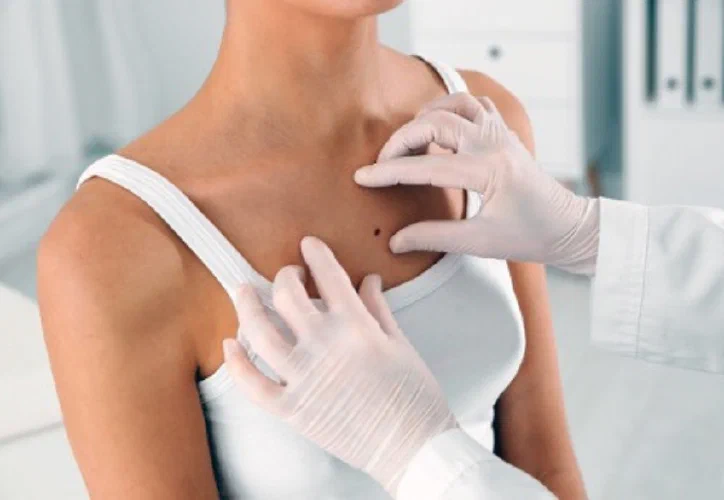 Advanced Epilation Award Level 4 - CIBTAC related image