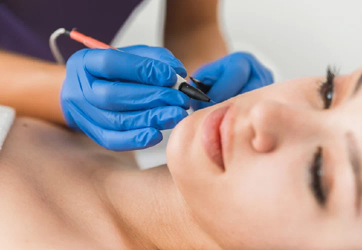 Electrolysis Refresher related image
